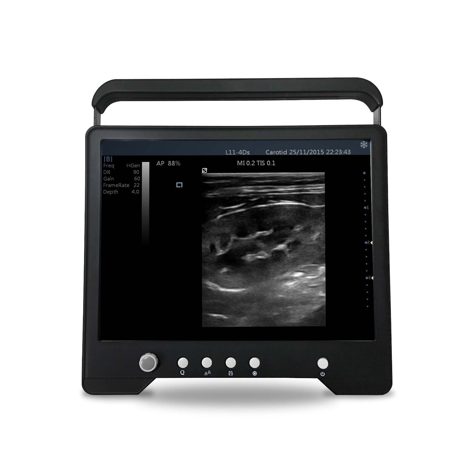 Veterinario Touchscreen Ultrasoundµ-convex Sonda per S Animali, Keebomed DIAGNOSTIC ULTRASOUND MACHINES FOR SALE