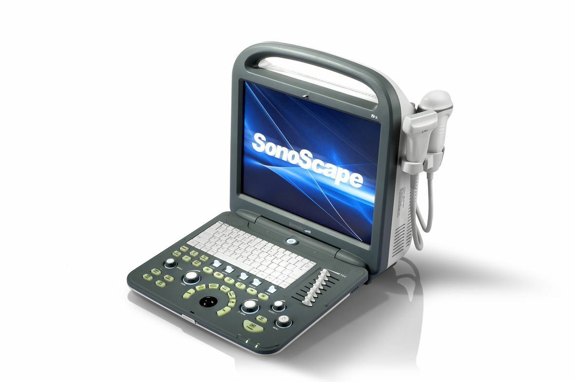 SonoScape S2 with Convex Abdominal Probe Included - Excellent Condition DIAGNOSTIC ULTRASOUND MACHINES FOR SALE