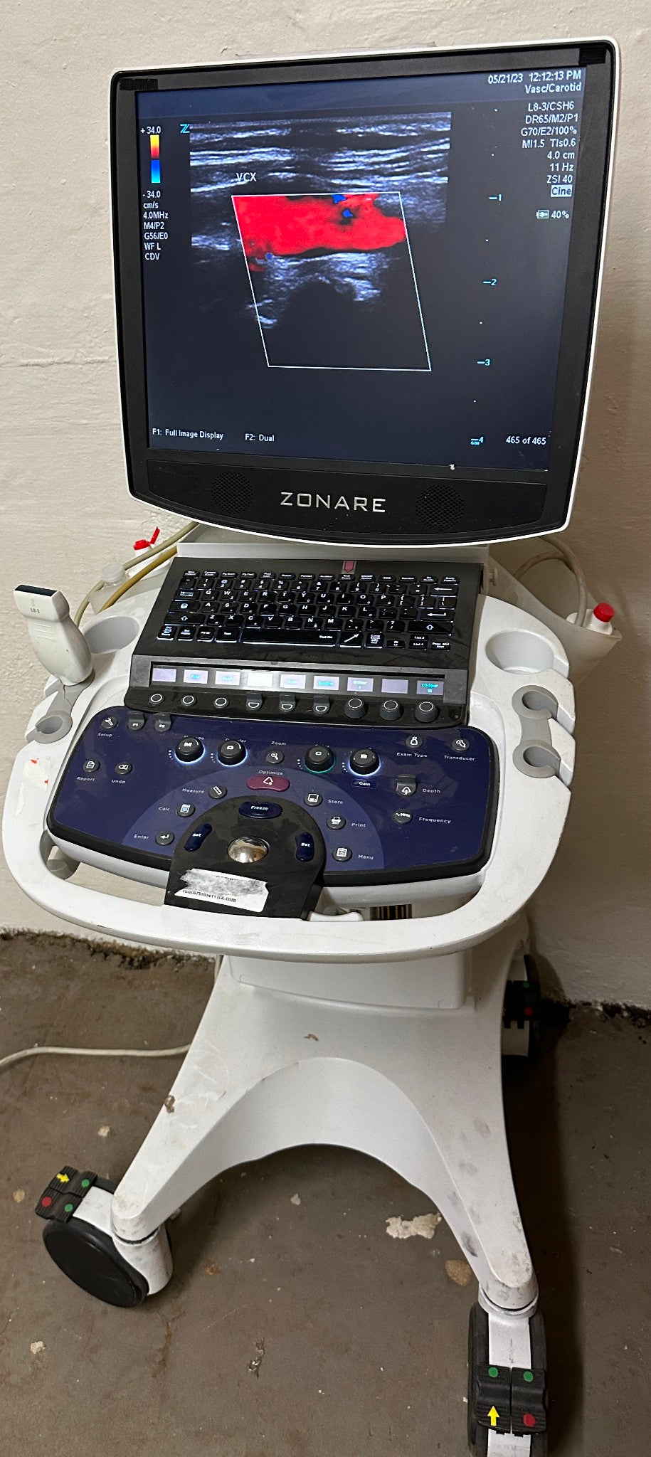 ZONARE ZS 3 Ultrasound Scanner Machine 2015 DIAGNOSTIC ULTRASOUND MACHINES FOR SALE