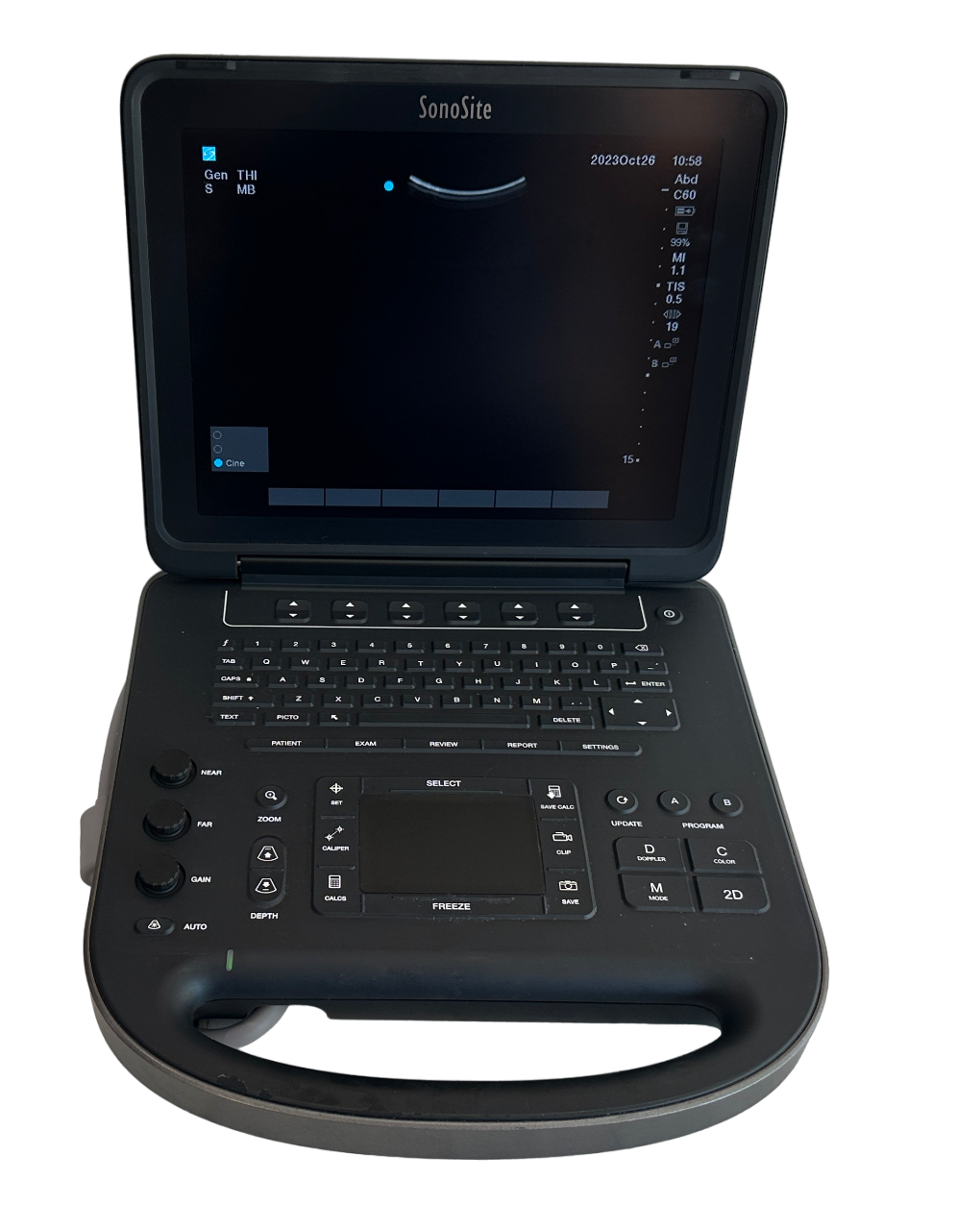 Sonosite Edge II Ultrasound 2017/Color, DICOM & 3 Probes L38xi & rC60Xi rP19x DIAGNOSTIC ULTRASOUND MACHINES FOR SALE