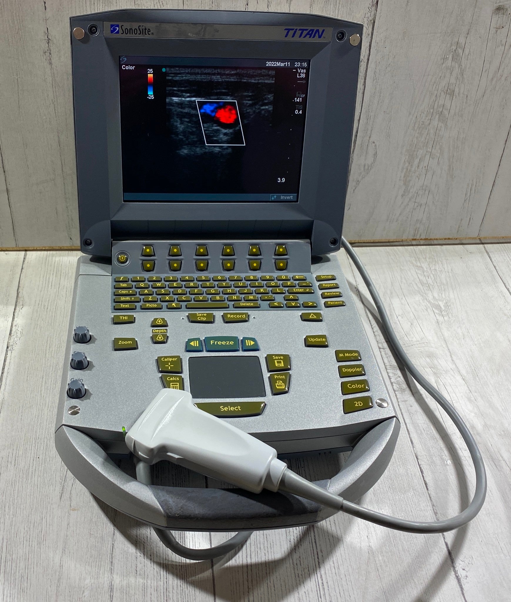 Sonosite Titan Portable Ultrasound 2007 - With Linear Array probe L38/10-5 DIAGNOSTIC ULTRASOUND MACHINES FOR SALE
