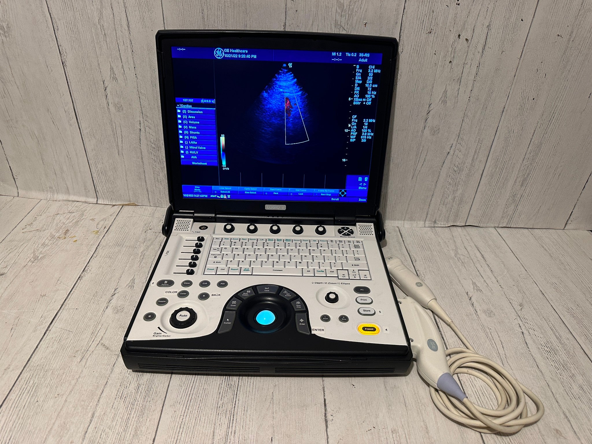 GE LOGIQ E Next Generation Ultrasound BT12 with 3S-RS Probe 2012 DIAGNOSTIC ULTRASOUND MACHINES FOR SALE