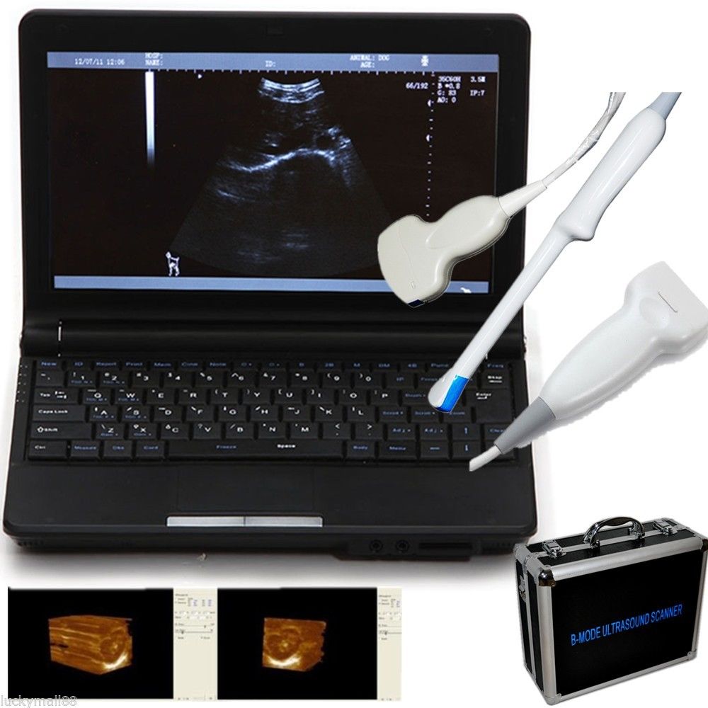 Laptop Machine Ultrasound Scanner Convex/Linear/Endovaginal Probe + 3D Software 190891044686 DIAGNOSTIC ULTRASOUND MACHINES FOR SALE