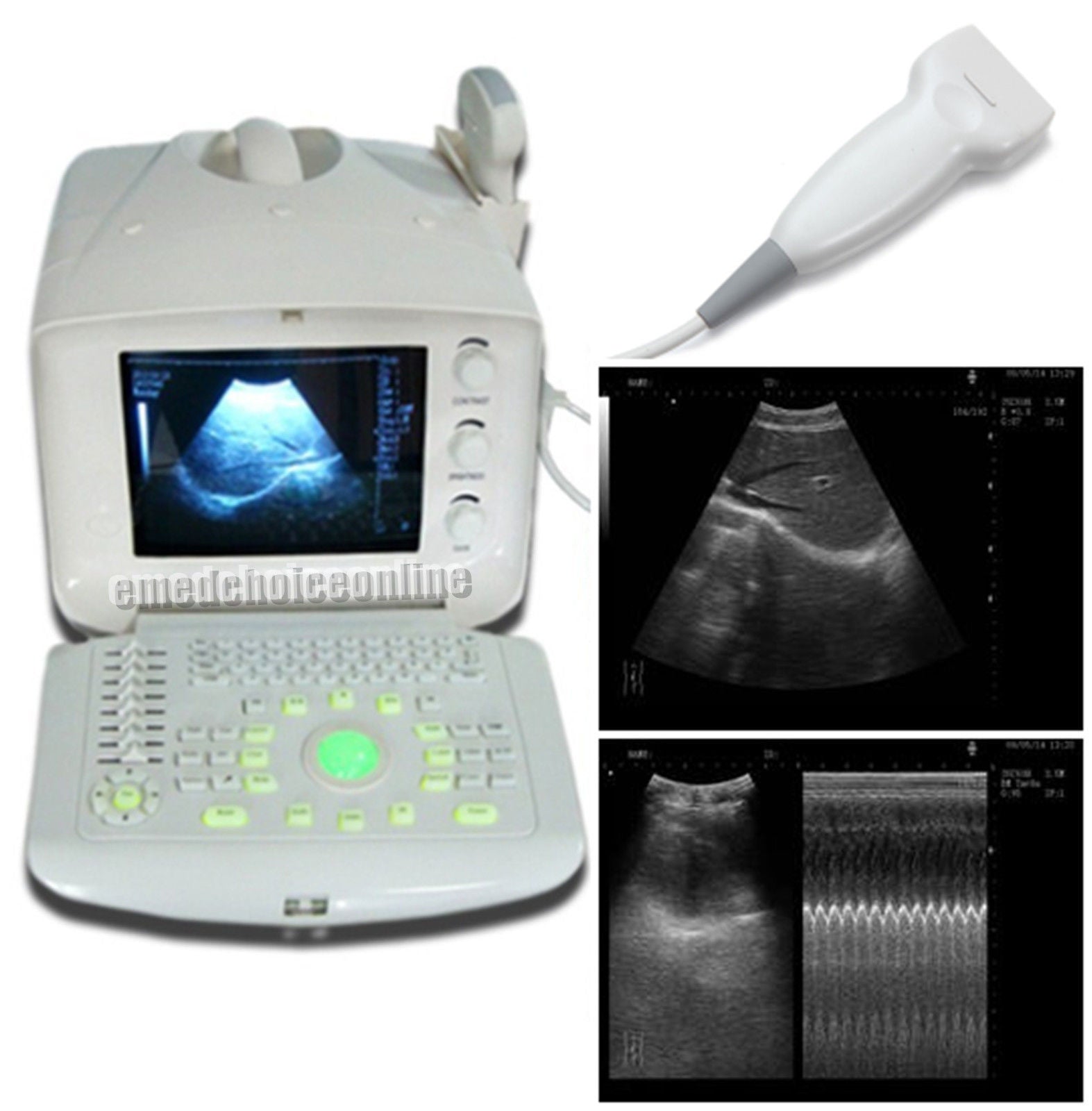 Digital Portable Machine Ultrasound Scanner 7.5Mhz Linear probe USB port 3D Sale DIAGNOSTIC ULTRASOUND MACHINES FOR SALE
