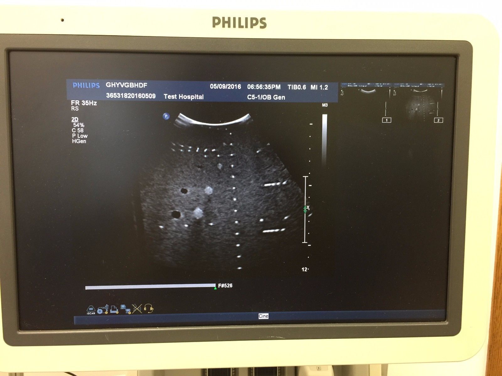 monitor of ultrasound