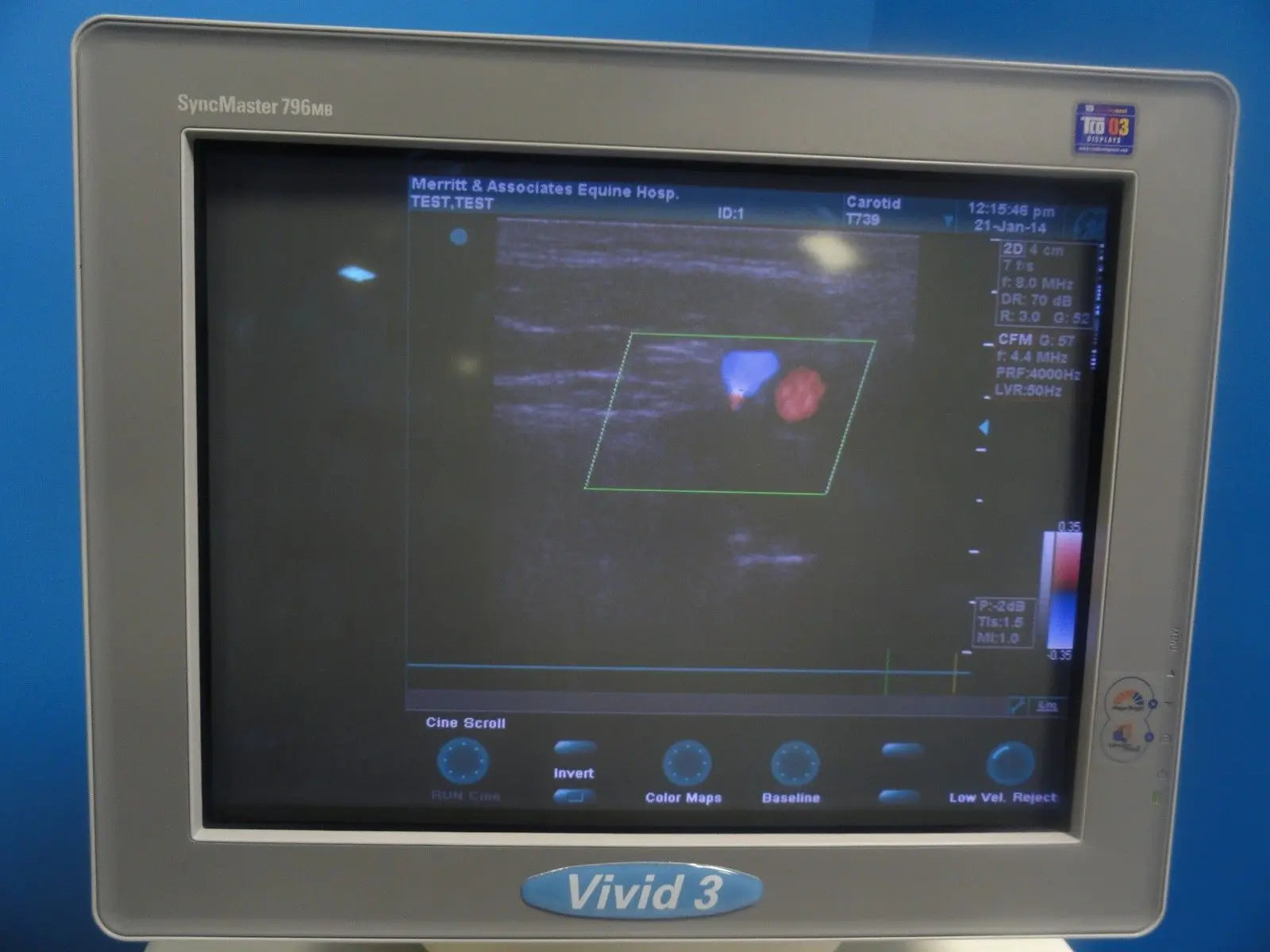 GE T739 P/N 2128151-2 6.7/D5.0 MHz Linear Array Ultrasound Transducer (6246) DIAGNOSTIC ULTRASOUND MACHINES FOR SALE