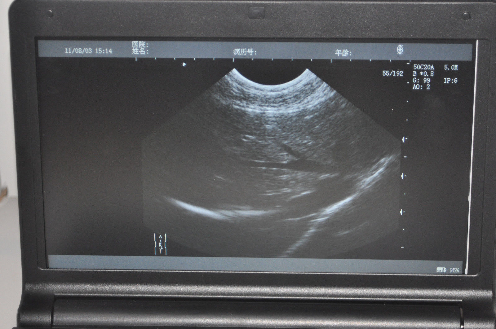 Digital Laptop Ultrasound Scanner/Machine/System convex+micro-convex+3D 2 probes 190891457554 DIAGNOSTIC ULTRASOUND MACHINES FOR SALE