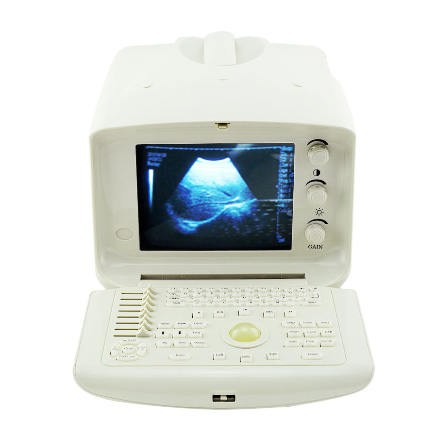 New Digital Ultrasound Scanner Machine System CE, Convex + Transvaginal Probe 3D 190891052773 DIAGNOSTIC ULTRASOUND MACHINES FOR SALE