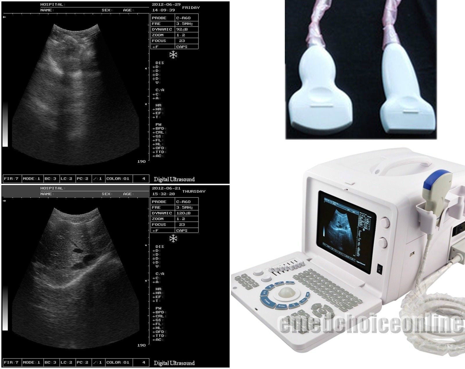 Digital Ultrasound machine Scanner Convex + linear Probe +3D Worksation CE Sale 190891802941 DIAGNOSTIC ULTRASOUND MACHINES FOR SALE