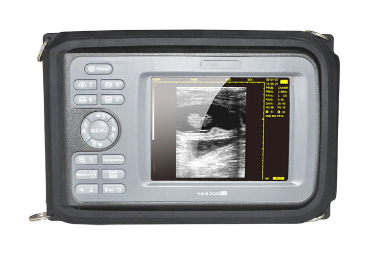 Handheld Palmtop Machine Ultrasound Scanner Cardiac Micro-Convex Probe Sale CE 190891436733 DIAGNOSTIC ULTRASOUND MACHINES FOR SALE