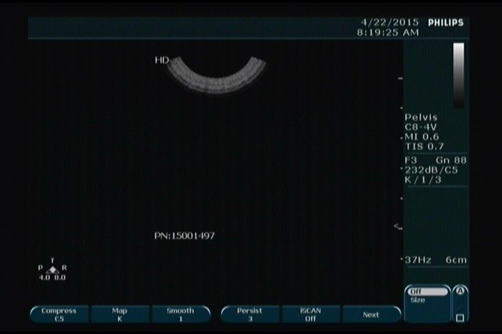 black monitor
