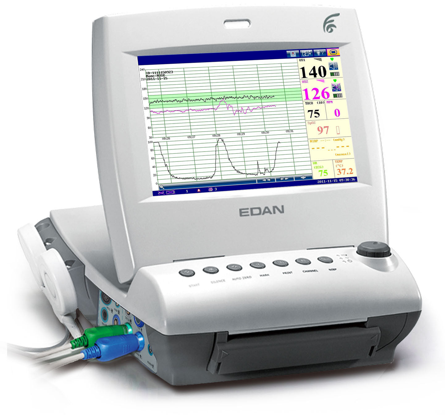 NEW ! EDAN F6T 10.1" TFT LCD DIsplay Fetal Monitor for TWINS DIAGNOSTIC ULTRASOUND MACHINES FOR SALE