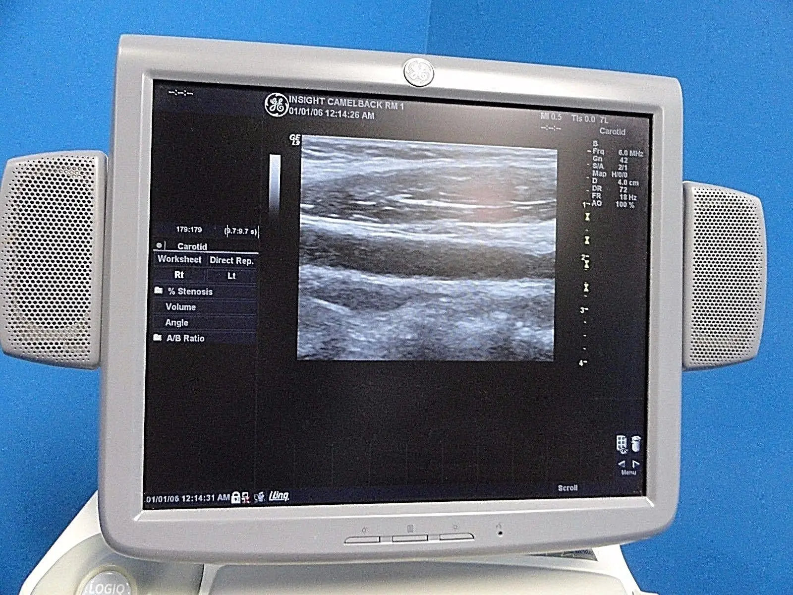 GE 7L Linear Array Ultrasound Probe P/N 2197482 for Logiq & Vivid Series~13729 DIAGNOSTIC ULTRASOUND MACHINES FOR SALE