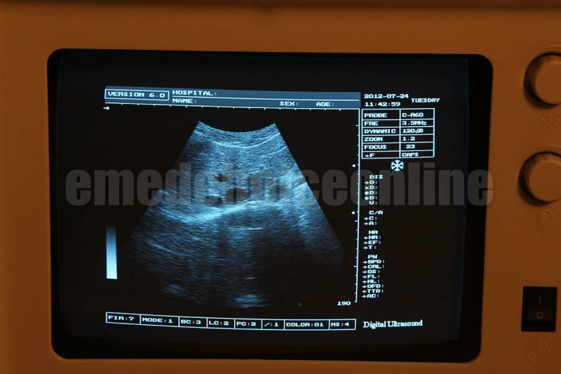 Portable Ultrasound Scanner Diagnostic 7.5 Linear Probe External 3D software MED DIAGNOSTIC ULTRASOUND MACHINES FOR SALE