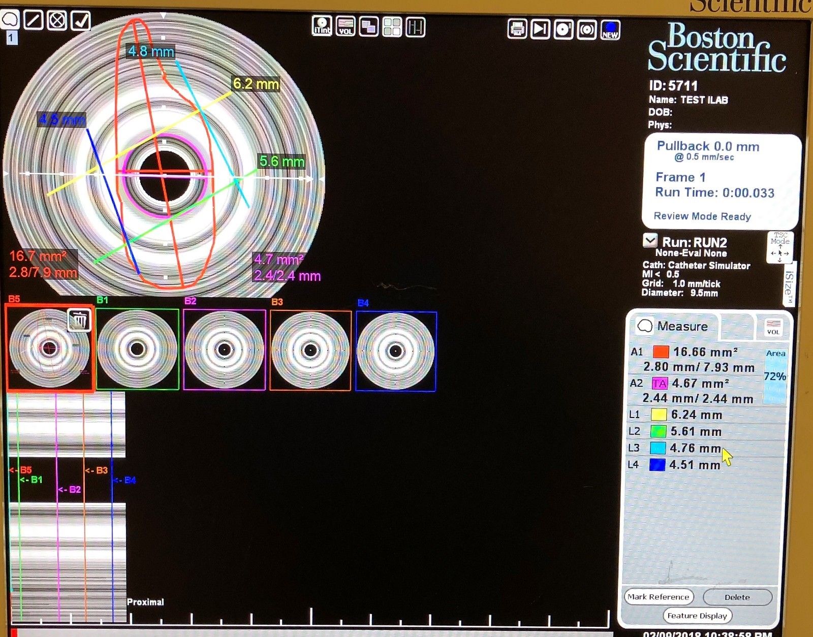 Boston Scientific iLab Ultrasound Imaging System with 2 Probes & More DIAGNOSTIC ULTRASOUND MACHINES FOR SALE