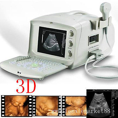 Portable Machine Digital Ultrasound Scanner Transvaginal Probe 3D Software Price 190891982230 DIAGNOSTIC ULTRASOUND MACHINES FOR SALE