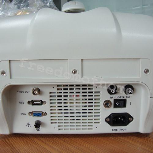 Full Digital Portable Ultrasound Scanner machine +Convex + Vignial 2 Probes+3D DIAGNOSTIC ULTRASOUND MACHINES FOR SALE