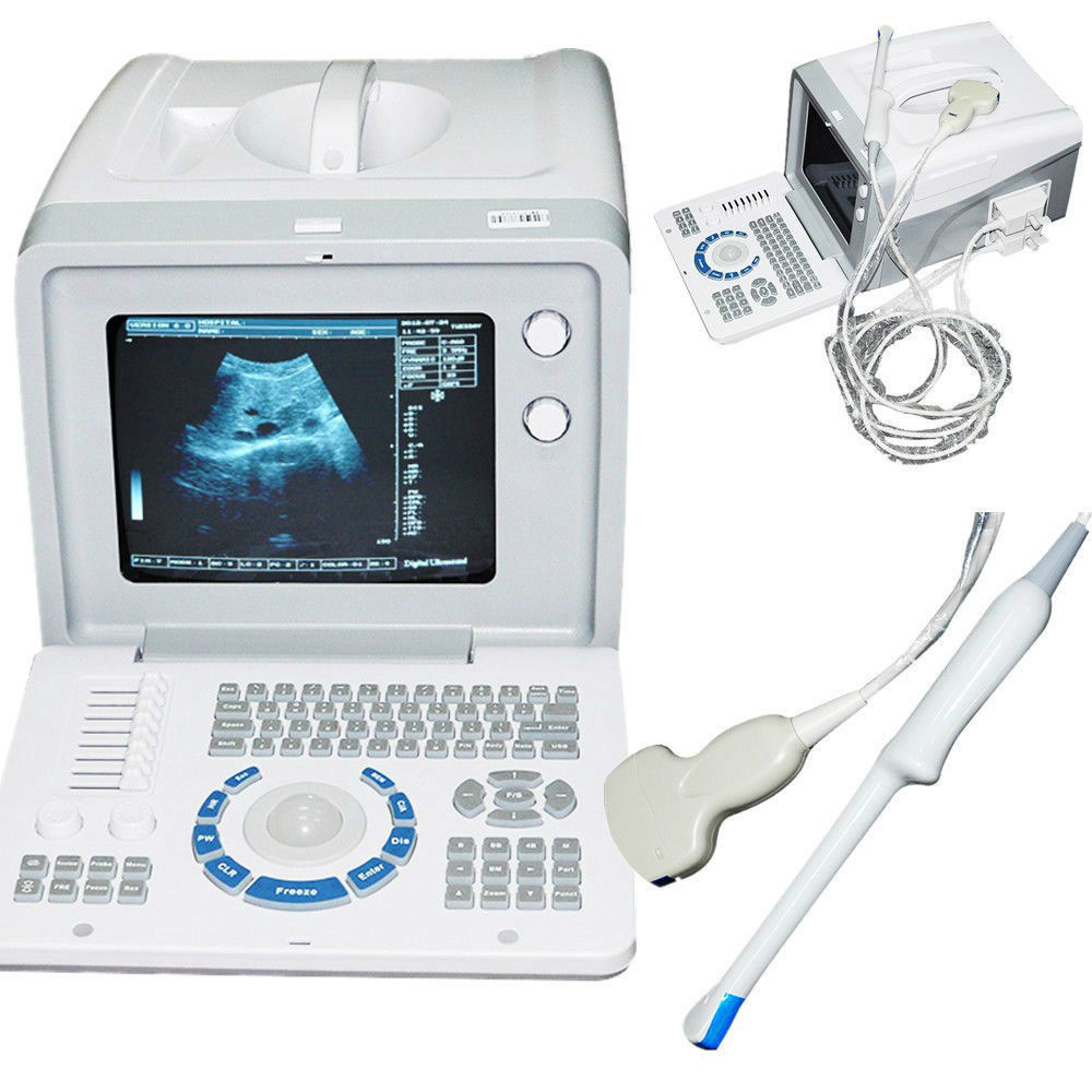 Diagnostic Ultrasound Scanner Machine Convex +Transvaginal Probe pregnancy week DIAGNOSTIC ULTRASOUND MACHINES FOR SALE