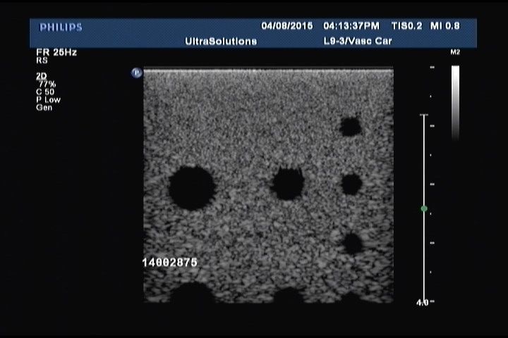 image of ultrasound
