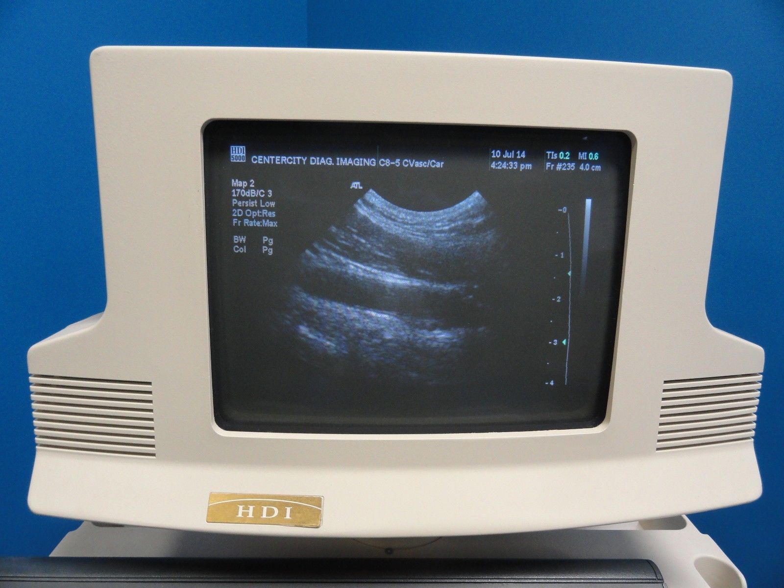 ATL C8-5 14R Micro-Convex Pediatric Small Parts Vascular MSK OB Probe (6865) DIAGNOSTIC ULTRASOUND MACHINES FOR SALE