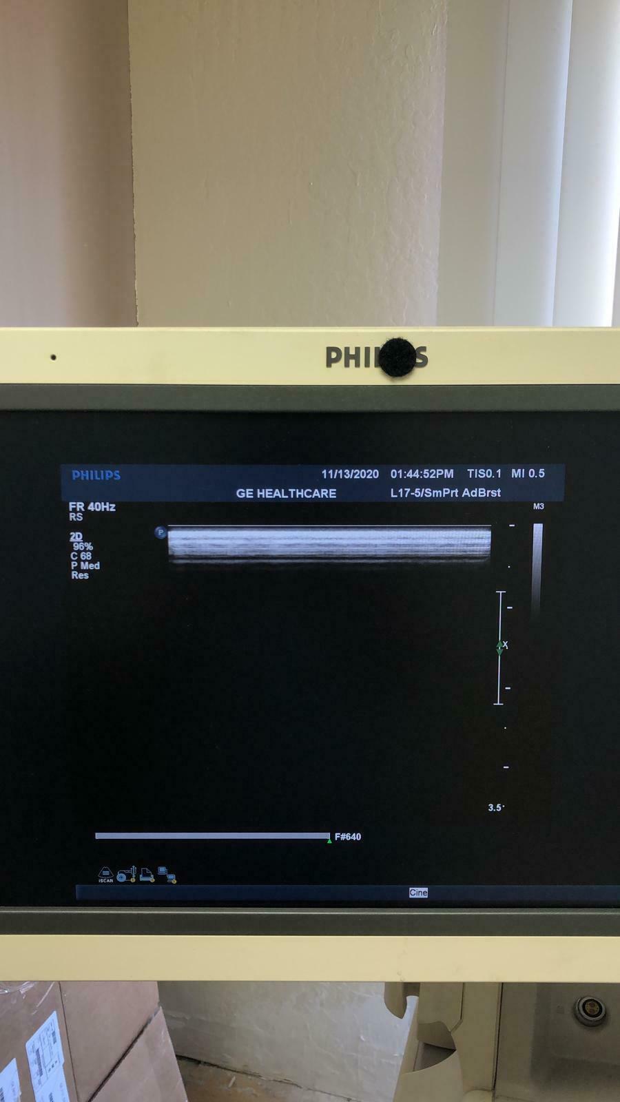 Philips Transducer L17-5 Ultrasound Transducer Probe DIAGNOSTIC ULTRASOUND MACHINES FOR SALE