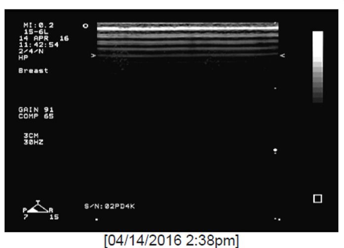a black and white ultrasound photo