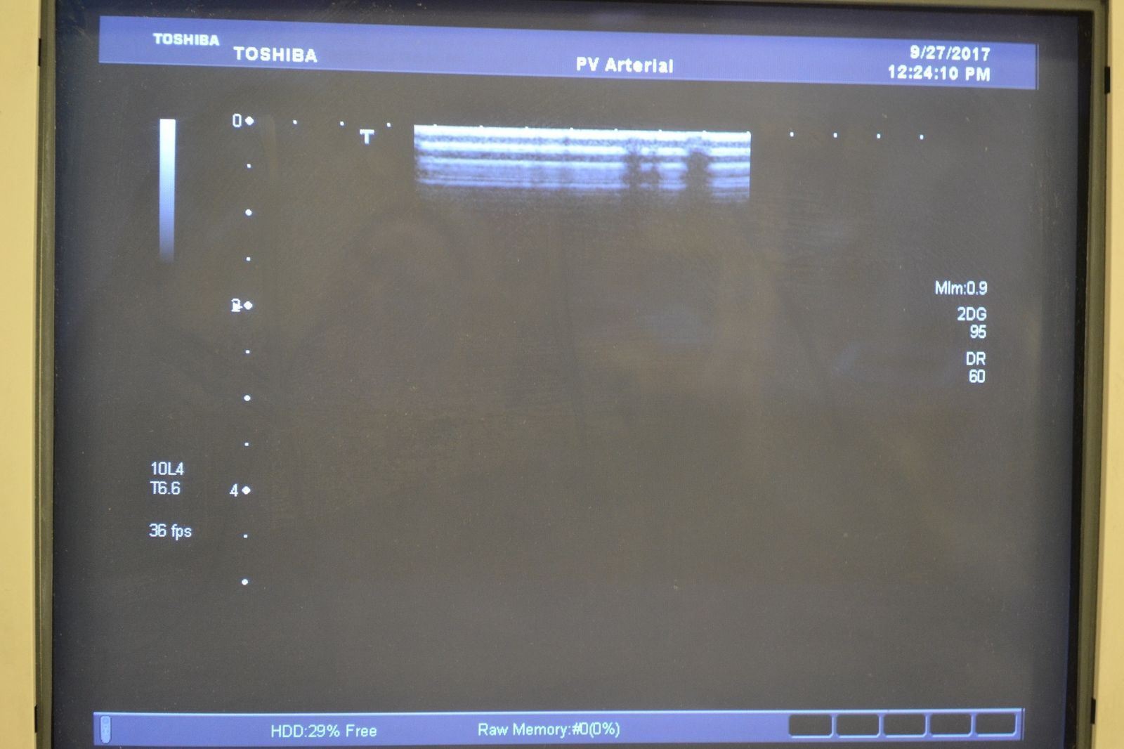 Toshiba Xario PLT-604AT 9.2-4MHz Linear Ultrasound Transducer Probe DIAGNOSTIC ULTRASOUND MACHINES FOR SALE