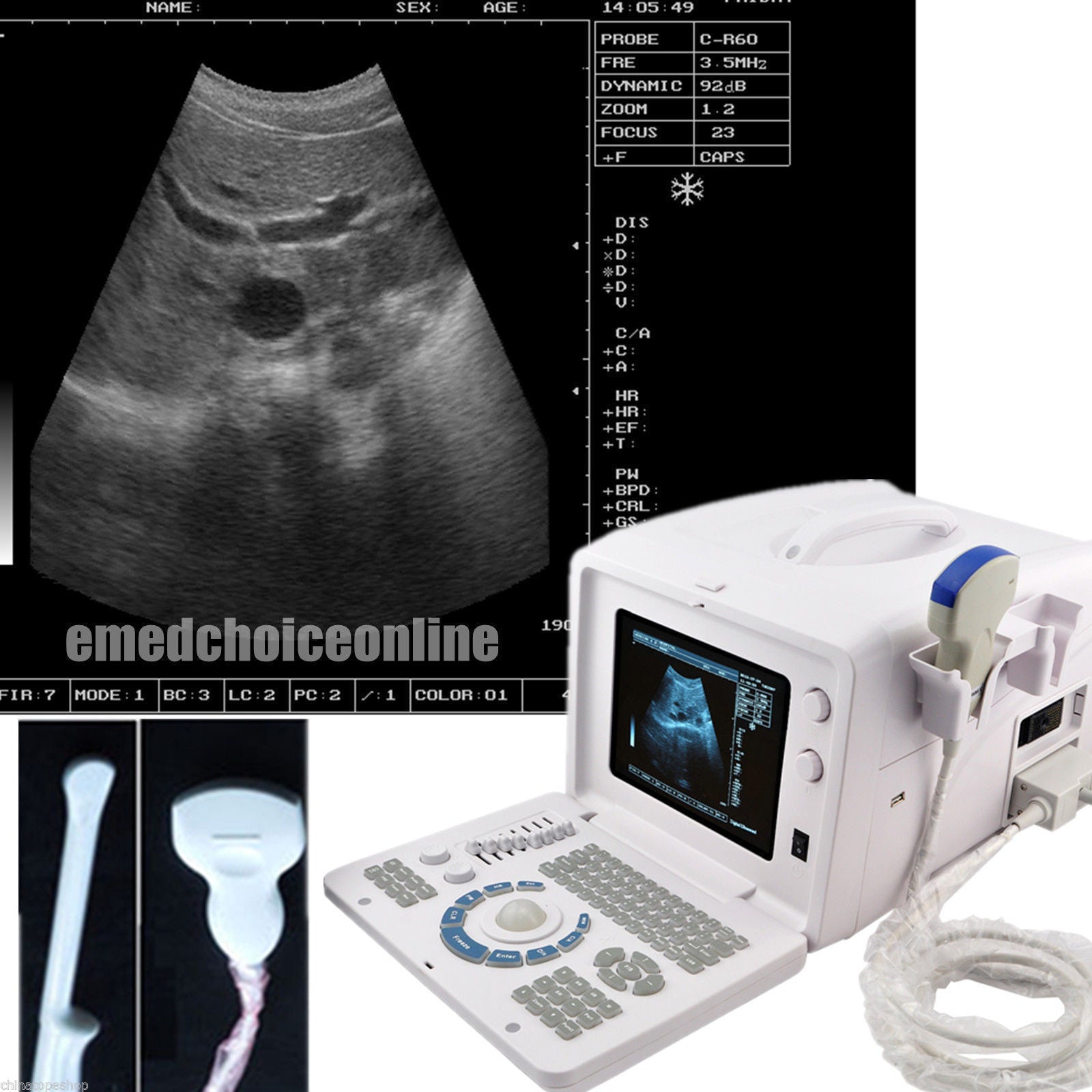 10'' Portable Ultrasound Scanner Machine Convex Viginal Probe 3 D Ultrasound AA 190891478306 DIAGNOSTIC ULTRASOUND MACHINES FOR SALE