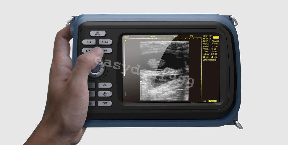 Portable Handheld Ultrasound Scanner + Transvaginal Probe + Rechargeable Battery DIAGNOSTIC ULTRASOUND MACHINES FOR SALE
