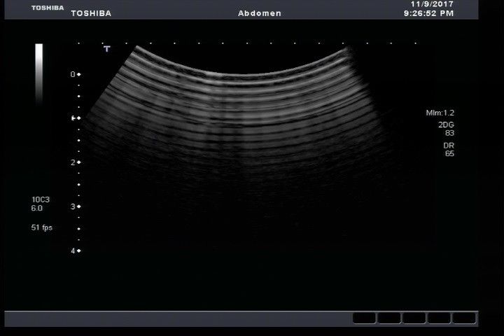 Toshiba PVT-674BT Convex Ultrasound Transducer Probe DIAGNOSTIC ULTRASOUND MACHINES FOR SALE