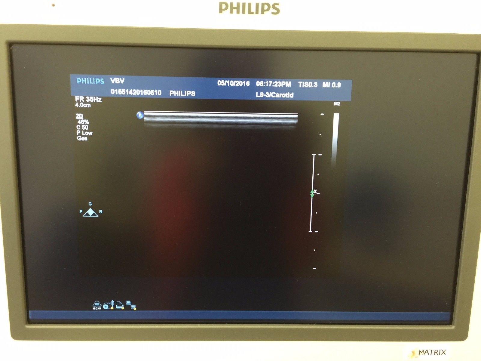 shot of monitor probe