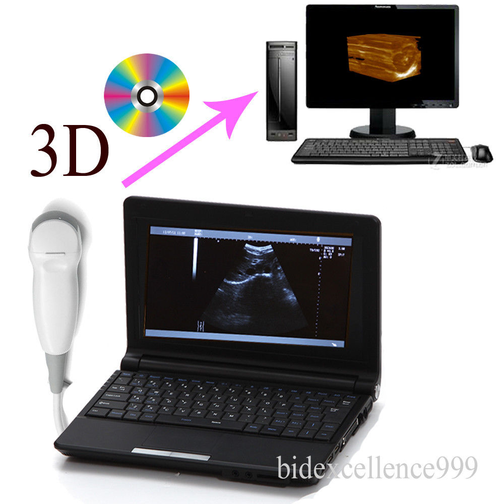 Digital Laptop Ultrasound Scanner Micro-Convex Probe External 3D Vet Veterinary 190891712110 DIAGNOSTIC ULTRASOUND MACHINES FOR SALE