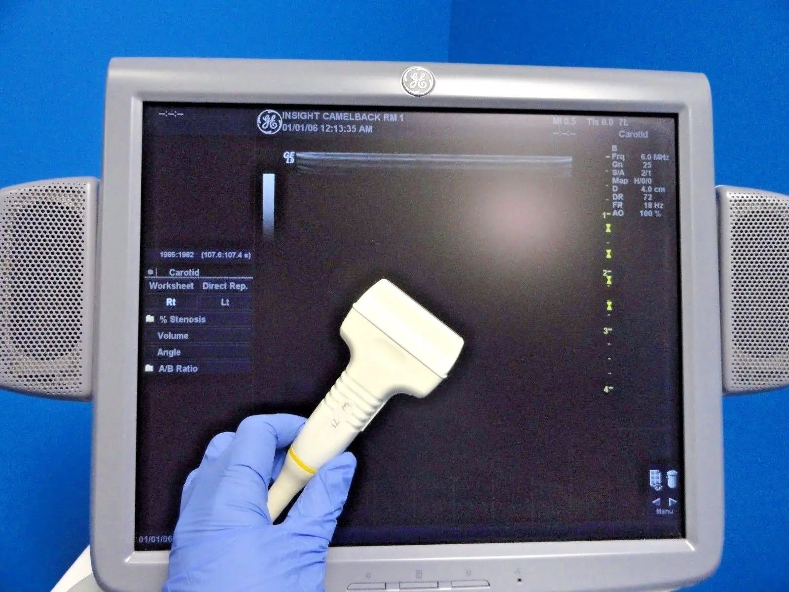 GE 7L Linear Array Ultrasound Probe P/N 2197482 for Logiq & Vivid Series~13729 DIAGNOSTIC ULTRASOUND MACHINES FOR SALE