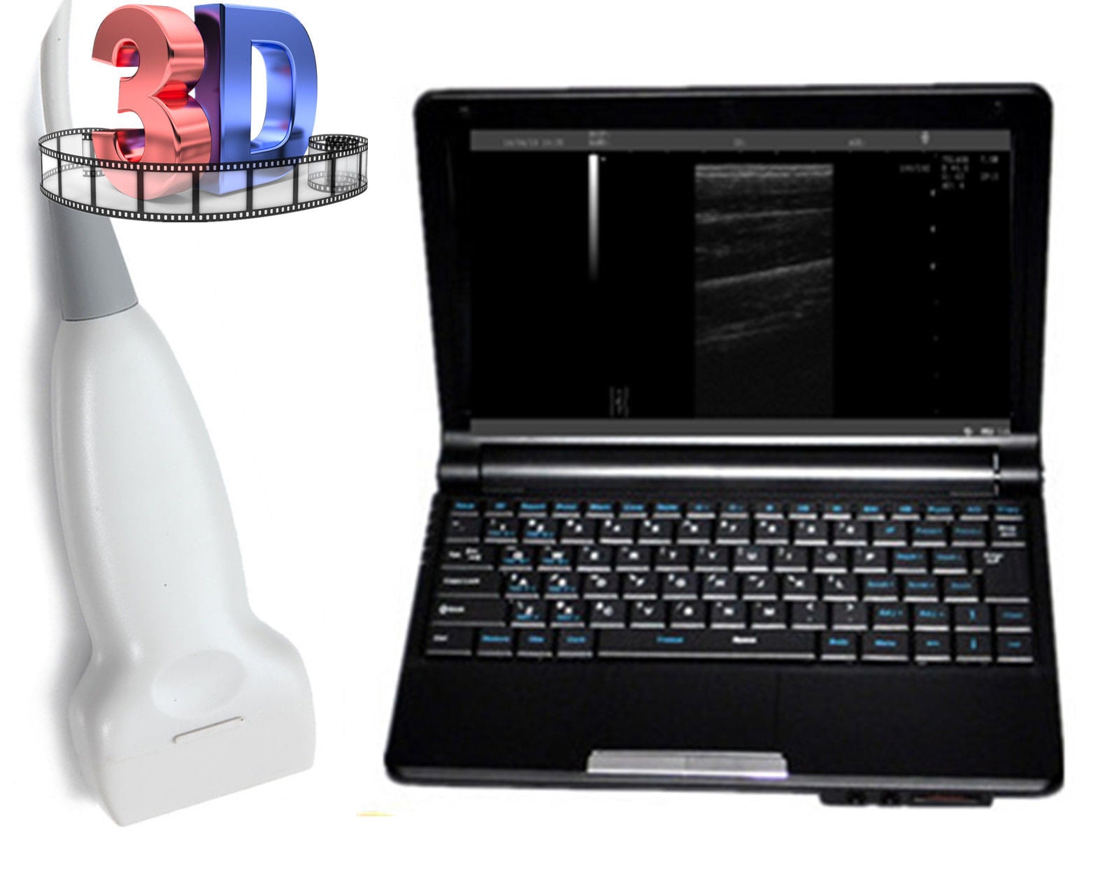 Laptop Ultrasonic Machine Ultrasound Scanner Linear Vascular Probe + Oximeter 190891797605 DIAGNOSTIC ULTRASOUND MACHINES FOR SALE