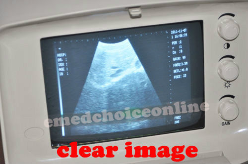 Portable Machine Digital Ultrasound Scanner System + Transvaginal Probe -EXT 3D 190891892607 DIAGNOSTIC ULTRASOUND MACHINES FOR SALE