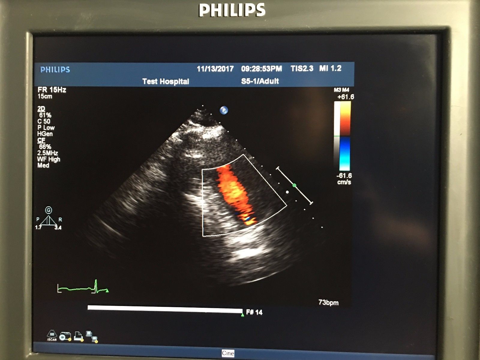 a computer screen showing a scan