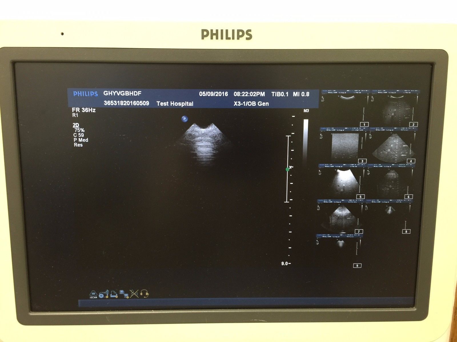 Philips x3-1 Ultrasound Transducer for Philips iE33 Ultrasound System DIAGNOSTIC ULTRASOUND MACHINES FOR SALE