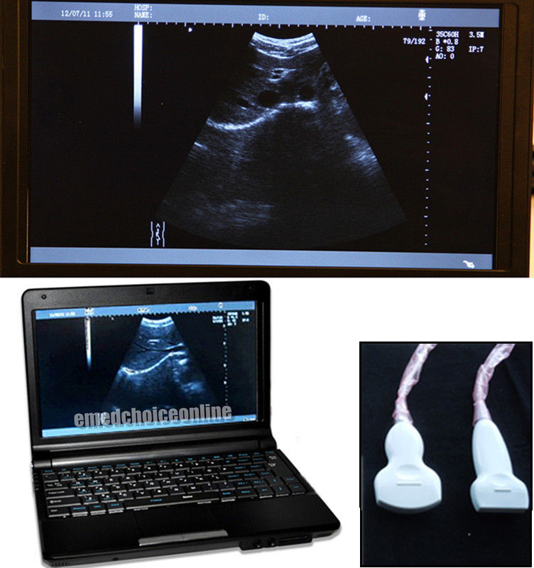 Full Digital Laptop Ultrasound Scanner+2 Probes Covex & Linear Probes Sale CE 3D 190891369093 DIAGNOSTIC ULTRASOUND MACHINES FOR SALE