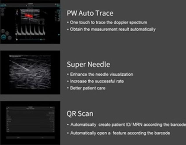 Supper Small Chison SonoEye P1 Linear Array for android Color Doppler Vascular DIAGNOSTIC ULTRASOUND MACHINES FOR SALE