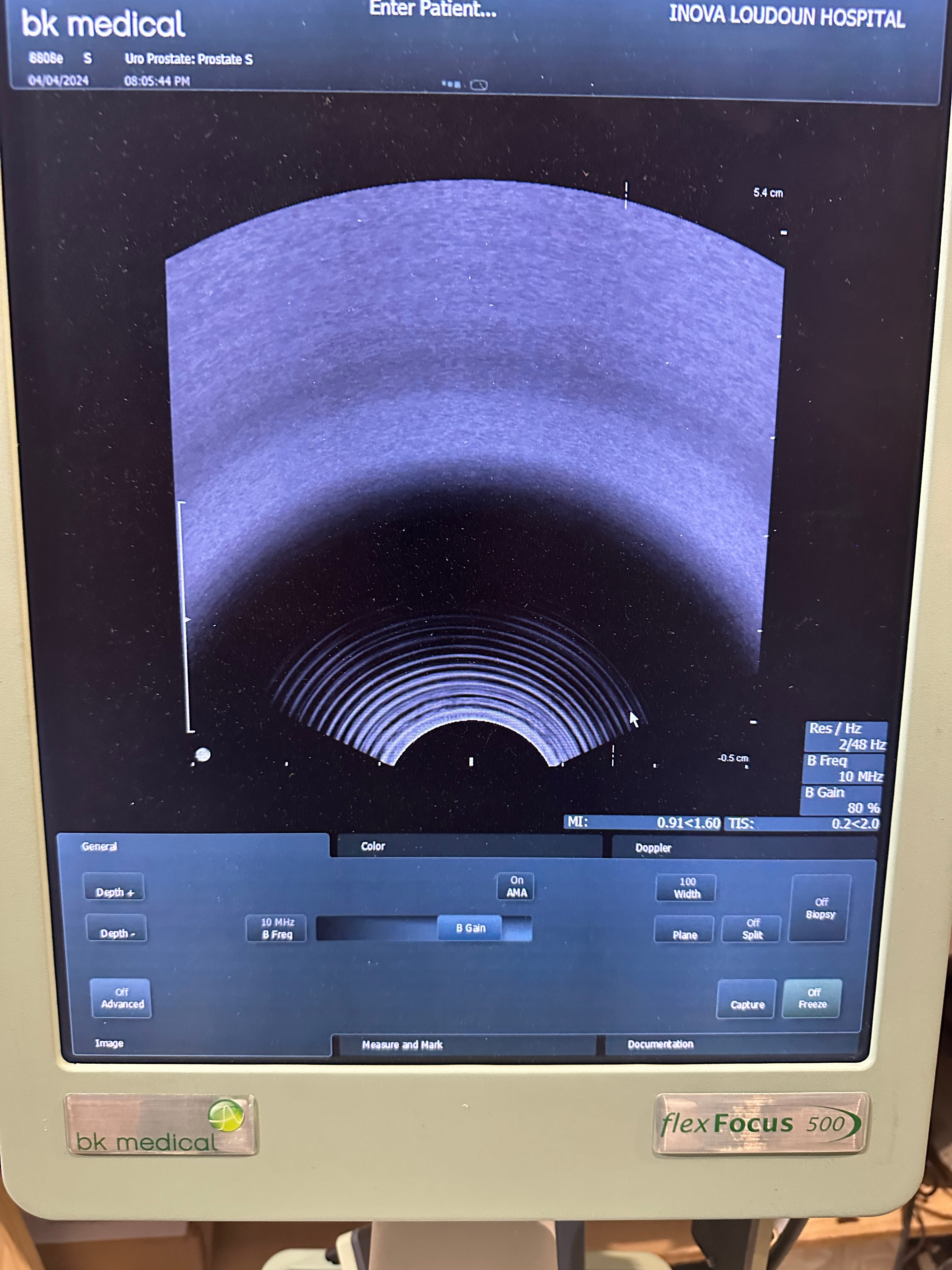 BK Medical Ultrasound Probe BK 8808e Endo Vaginal Transducer TV probe - DIAGNOSTIC ULTRASOUND MACHINES FOR SALE