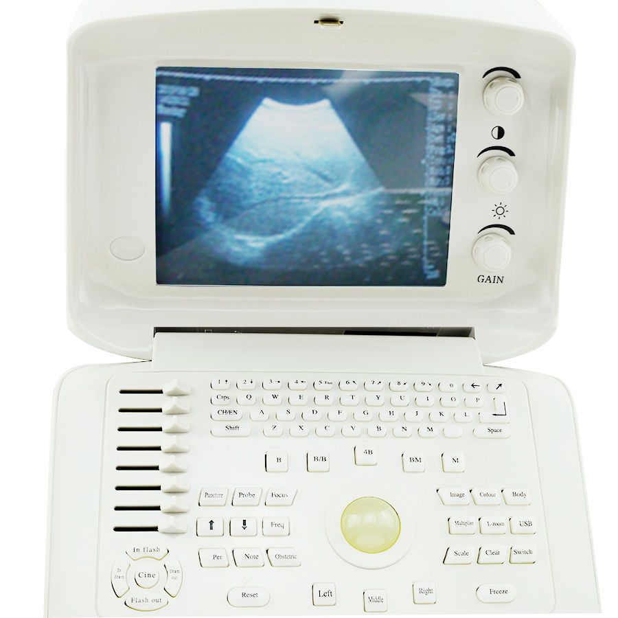 Medical Ultrasound Scanner Machine System CE, Convex + Transvaginal 2 Probe 3D 190891052773 DIAGNOSTIC ULTRASOUND MACHINES FOR SALE