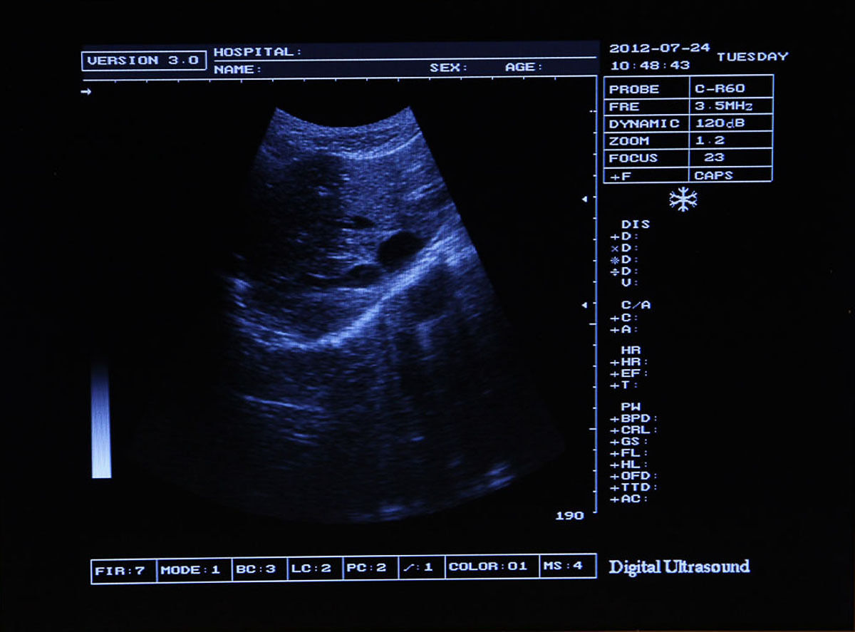 Digital Portable Ultrasound Scanner Machine +Linear probe/Transducer 3D Free DIAGNOSTIC ULTRASOUND MACHINES FOR SALE