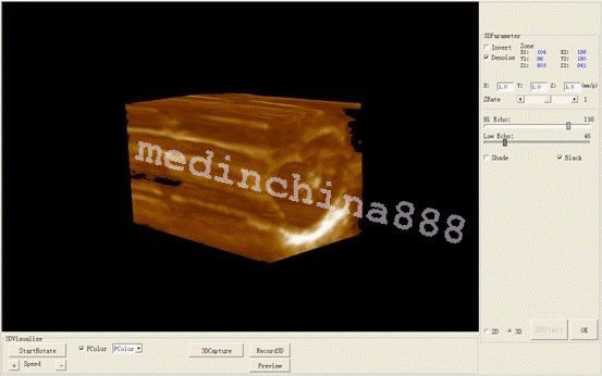 Man-Pack CCU ICU Ultrasound Scanner Convex + Linear 2 Probes Free 3D Best 190891255112 DIAGNOSTIC ULTRASOUND MACHINES FOR SALE