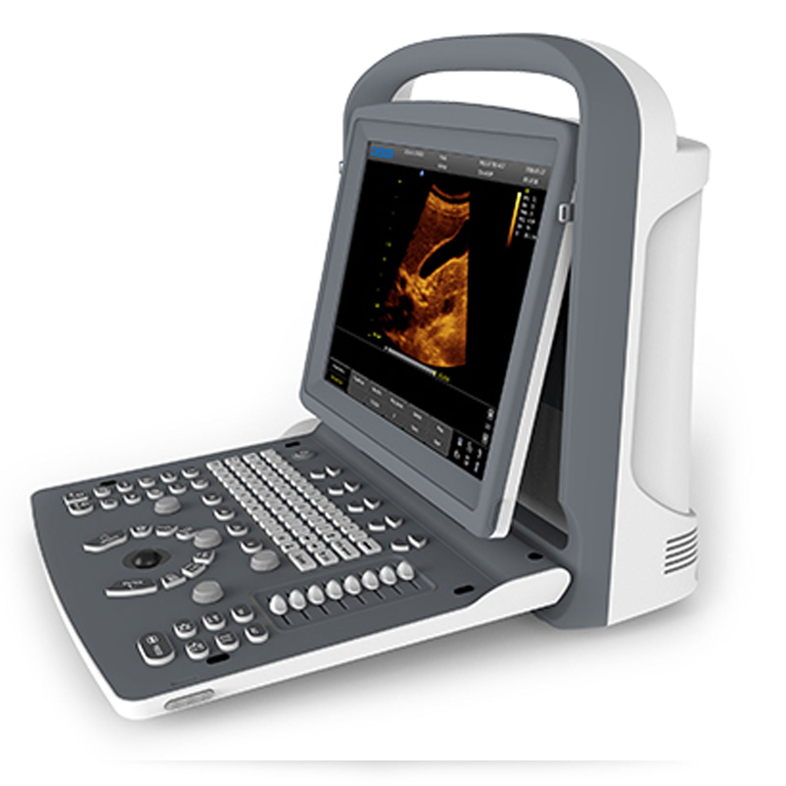 ECO2 Chison Portable Digital Ultrasound Scanner+3.5MHz ConvexProbe+CASE 2016 eee DIAGNOSTIC ULTRASOUND MACHINES FOR SALE