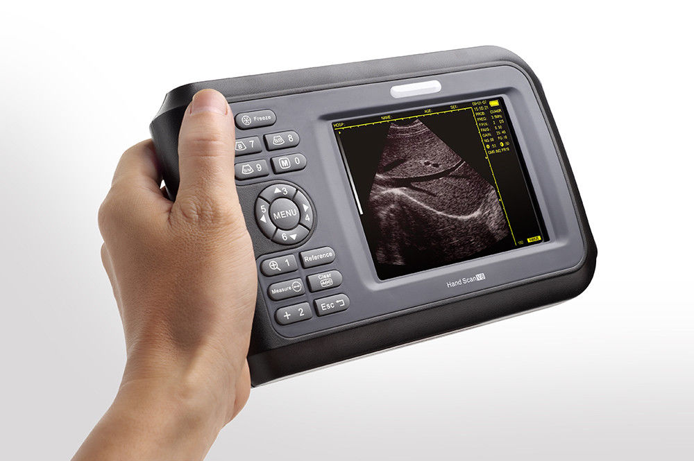 Handheld Ultrasound  Scanner Digital Machine w Linear Probe Free Box & Battery 190891515230 DIAGNOSTIC ULTRASOUND MACHINES FOR SALE