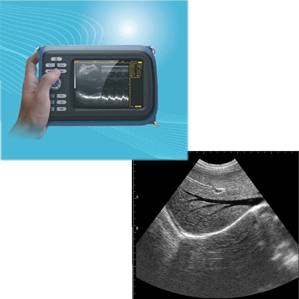 Laptop HandScan Digital Ultrasound Scanner system 7.5Mhz  Linear Probe + Case 190891758767 DIAGNOSTIC ULTRASOUND MACHINES FOR SALE