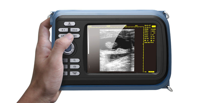 Handheld Ultrasound Scanner Machine Cardiac Micro-Convex Probe For Human Sale CE 190891435552 DIAGNOSTIC ULTRASOUND MACHINES FOR SALE