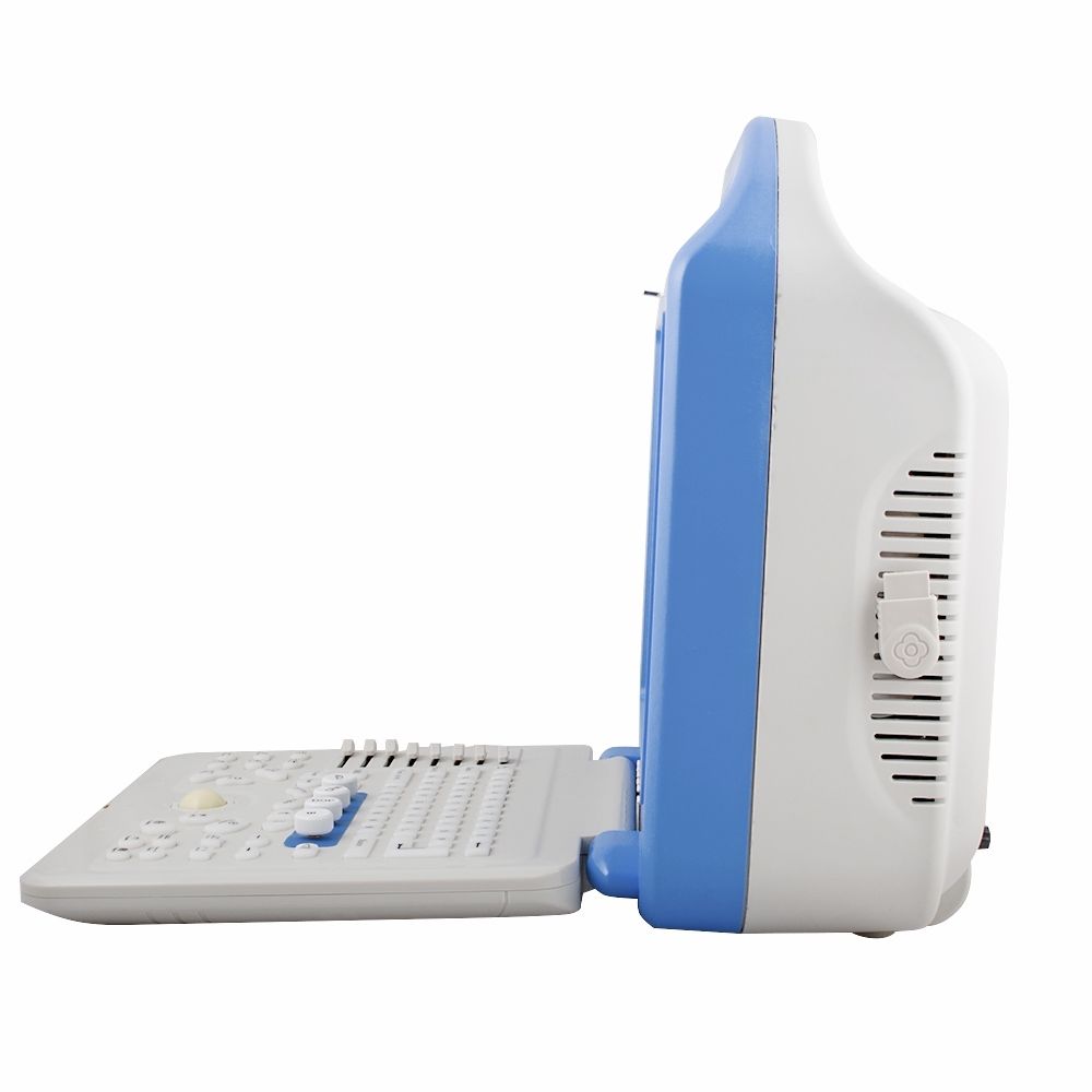 Laptop Color Doppler Ultrasonic Ultrasound Scanner Convex Linear 2 Probes  A+ DIAGNOSTIC ULTRASOUND MACHINES FOR SALE