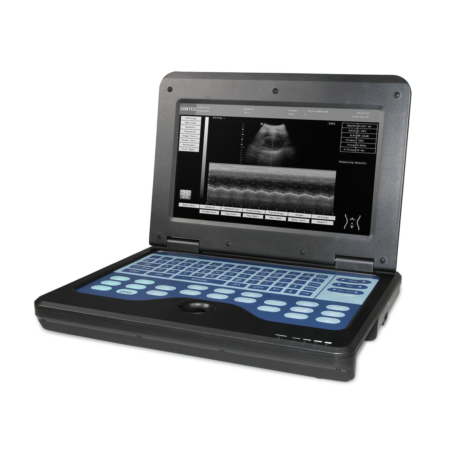 Portable Ultrasound Scanner Diagnostic Ultrasound Machine Convex+Transvaginal US DIAGNOSTIC ULTRASOUND MACHINES FOR SALE