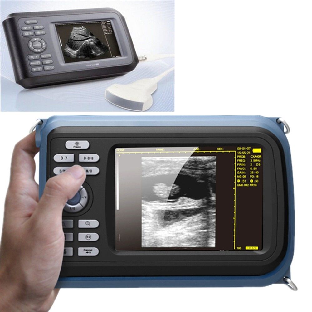 Laptop HandScan Digital Ultrasound machine Scanner system +7.5M HF linear Probe DIAGNOSTIC ULTRASOUND MACHINES FOR SALE